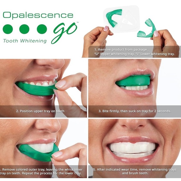 Go Teeth Whitening Kit - Picture 2 of 5